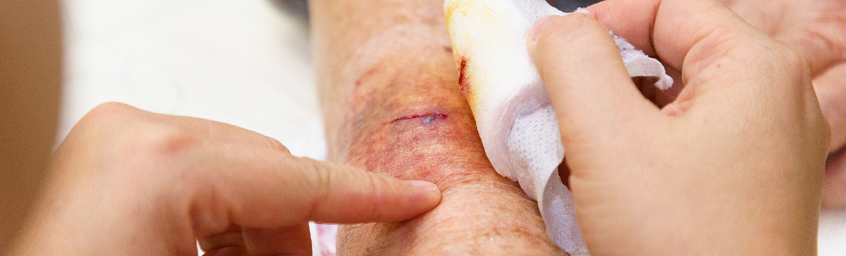 Cleaning a wound on an arm