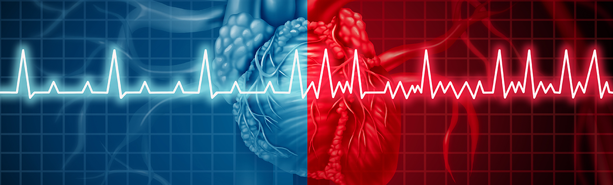 Regular and irregular heart beat graph